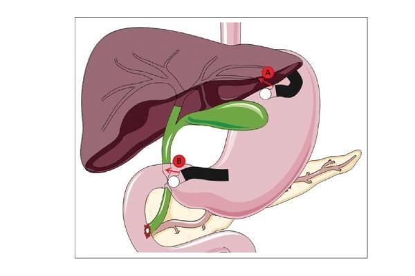 adithyagastroandlivercare