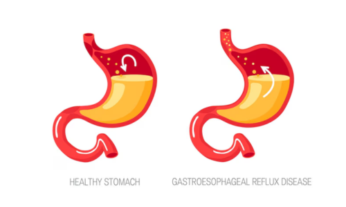 Gastroenterologist in Manikonda 