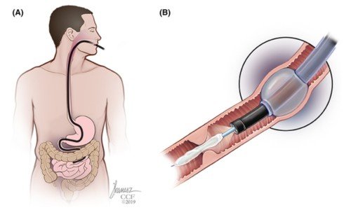 Gastroenterologist in Manikonda 