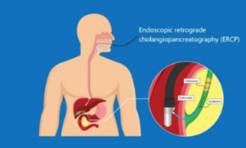 Gastroenterologist in Manikonda 